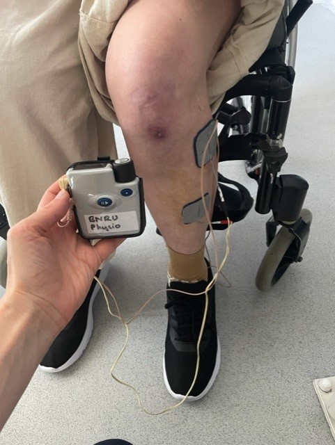 Functional Electrical Stimulator connected to a patients leg